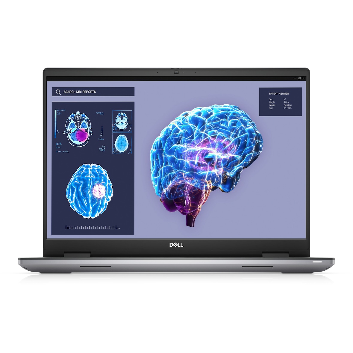 DELL Precision 7680 i7-13850HX 40,64cm 16Zoll FHD+ 32GB 1TB Nvidia RTX 2000 IR Cam & Mic SmtCd 6 Cell WLAN Blt Kb W11P 3Y ProSpt