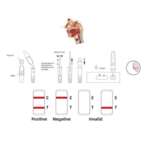Green Spring® PROFI SARS-CoV-2-Antigen Schnelltest (kolloidales Gold) 4in1 Profitest (25 Stück)